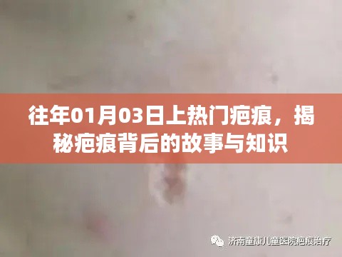 揭秘疤痕背后的故事与知识，一月三度热议话题